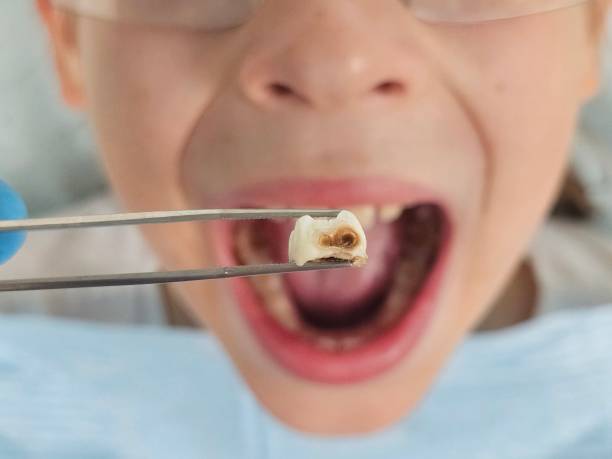 Best Emergency Treatment for Toothache in South Carthage, TN